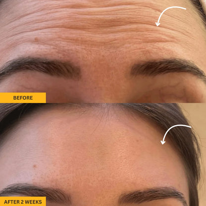 Contouré™- 5-Minute Reset for Your Face