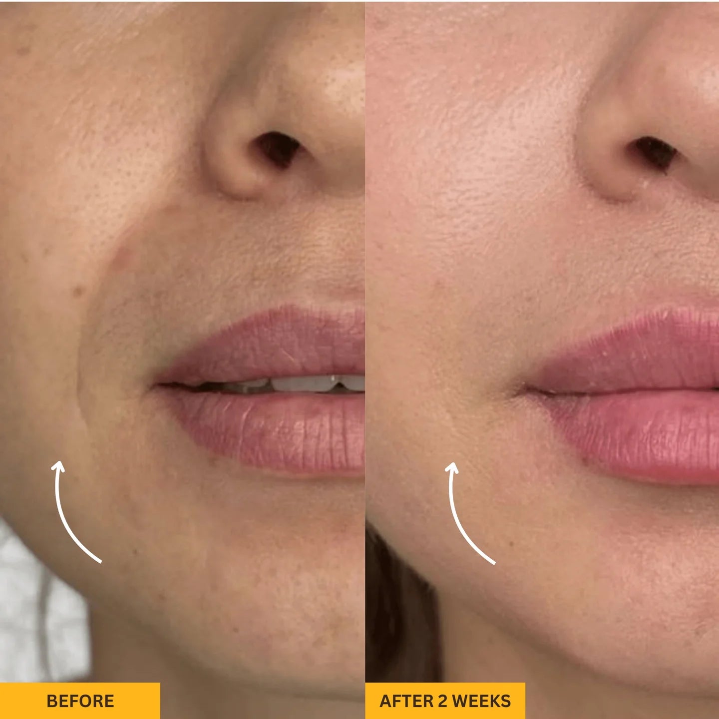 Contouré™- 5-Minute Reset for Your Face