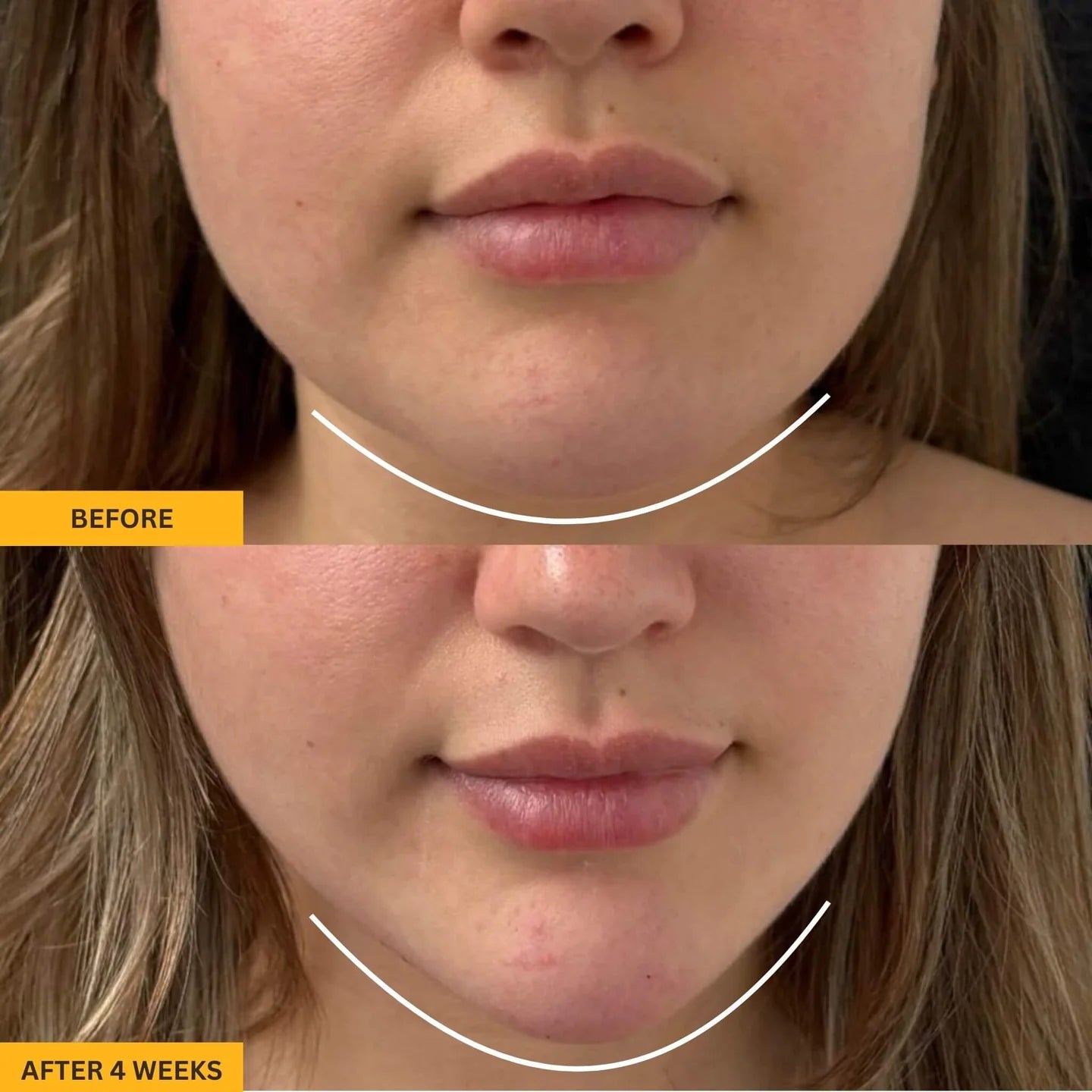 Contouré™- 5-Minute Reset for Your Face